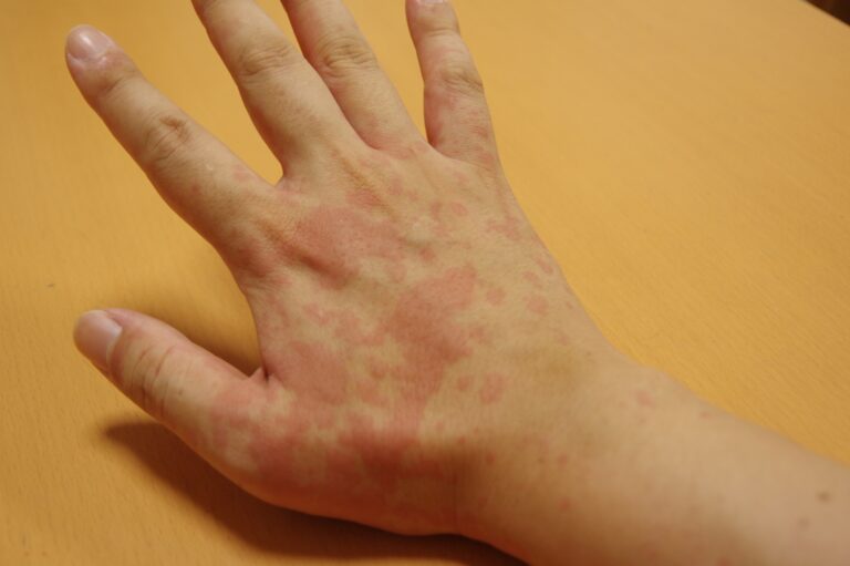 医師の診察を受ける時期